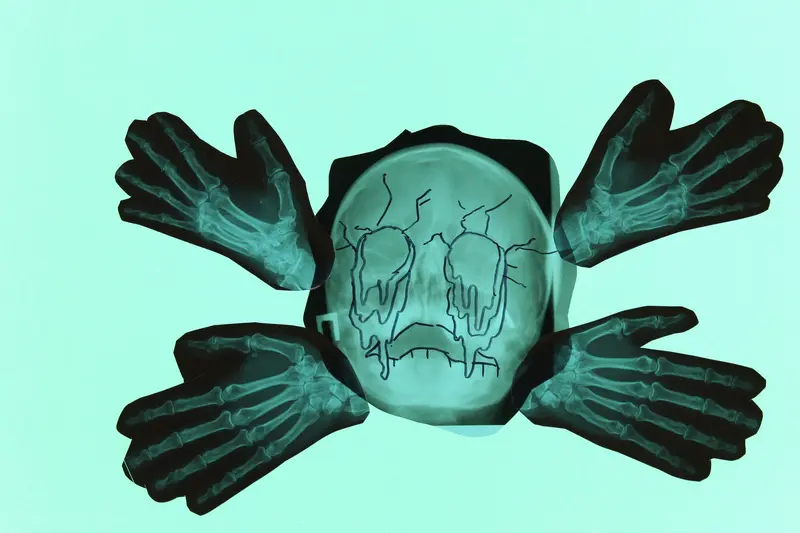 Bones